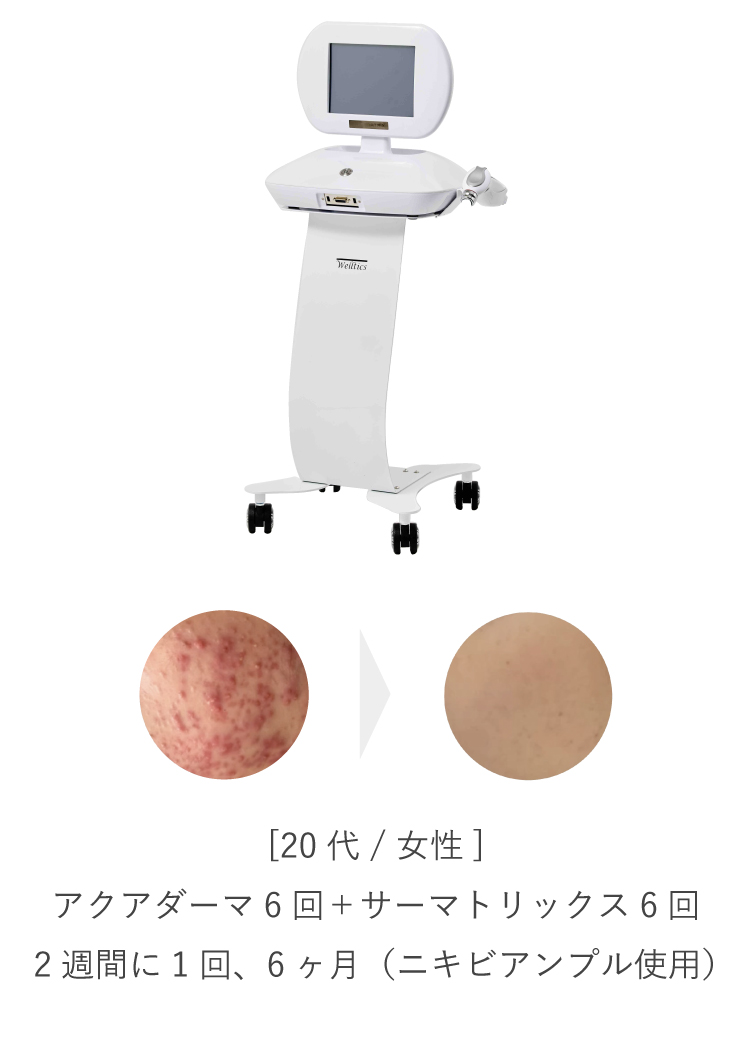 アクアダーマ - ラニィエンボーテ - LaNhien Beauté