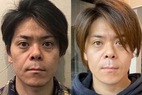 ルビーセルインテンシブ4Uセラム(ヒト幹細胞培養液5％配合 6㎖×18本