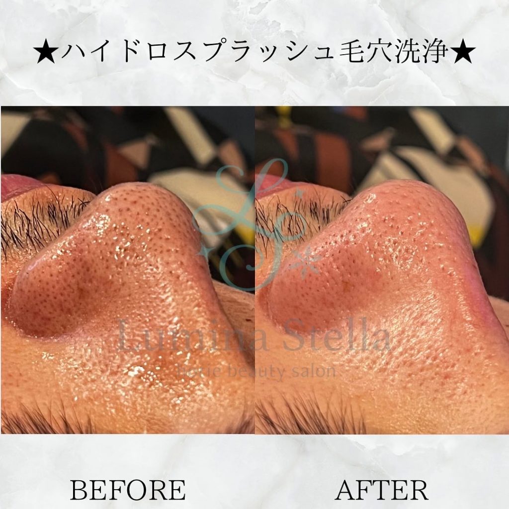 1DCED579-ECBB-4321-8D5B-