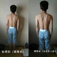 Amazon.co.jp: 新正体法入門 一瞬でゆがみが取れる矯正の方程式 : 橋本