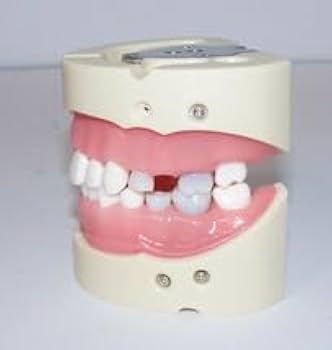 Amazon.co.jp: 歯科 模型 ニッシン 顎模型 根管治療 エンド NISSIN