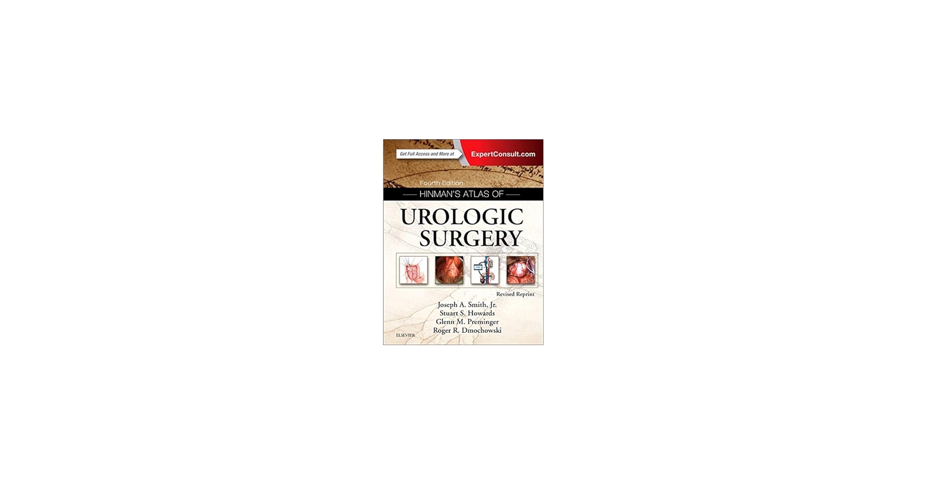 Hinman's Atlas of Urologic Surgery Revised Reprint: 8600007167991