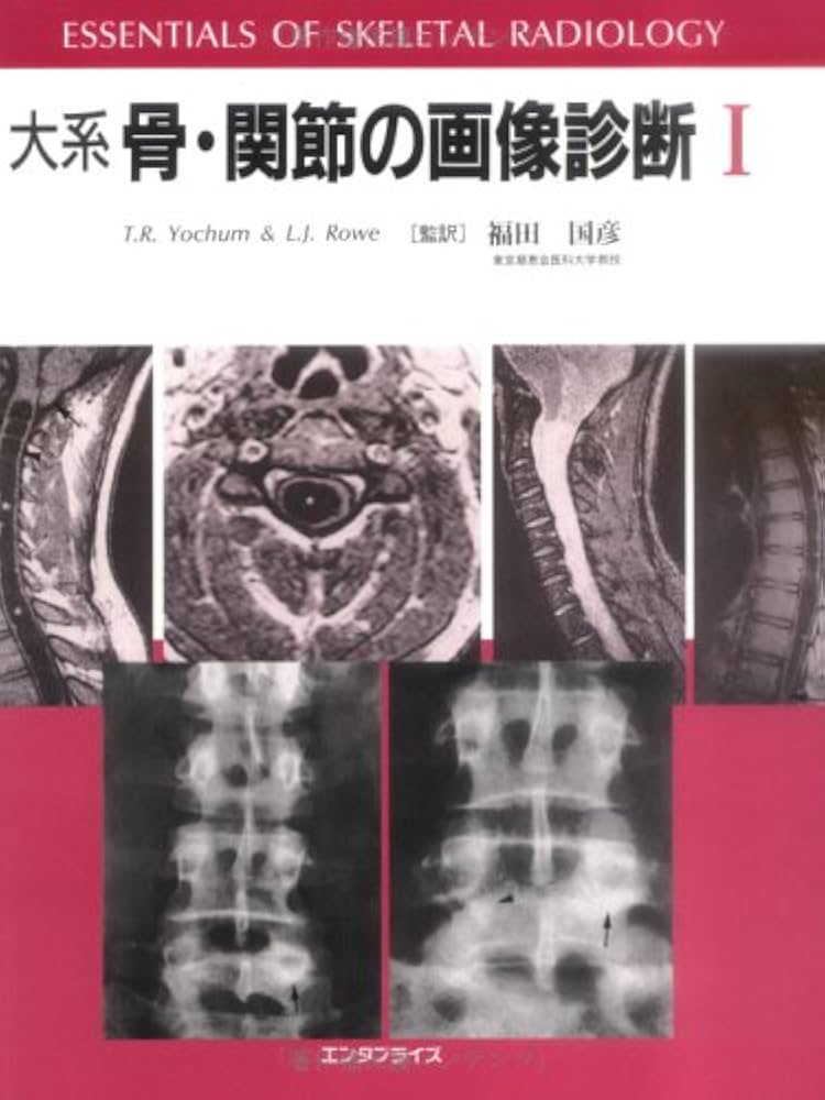 大系骨・関節の画像診断I II | T.R.ヨーカム, L.J.ロウ, 福田 国彦 |本