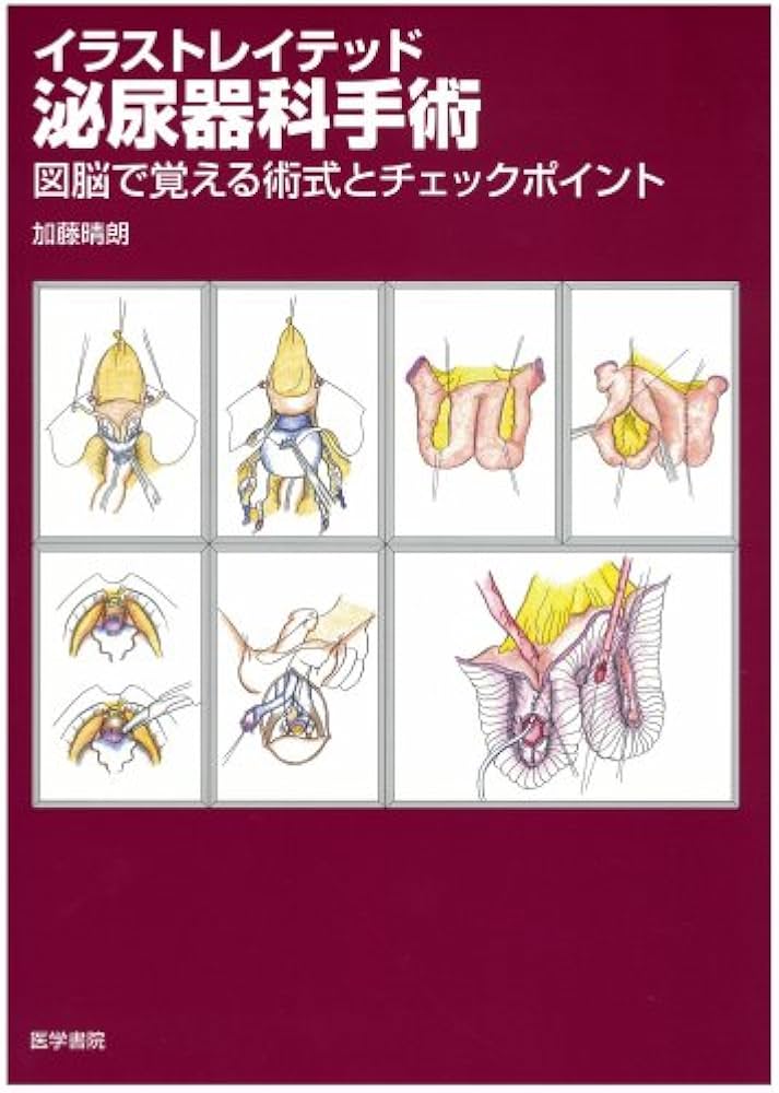 Amazon.co.jp: イラストレイテッド泌尿器科手術―図脳で覚える術式と