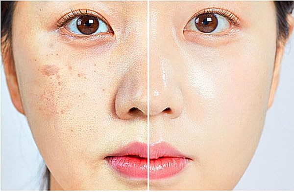 Amazon.com: WHITESILK (85%) Human Stem Cell & (10%) PDRN Anti