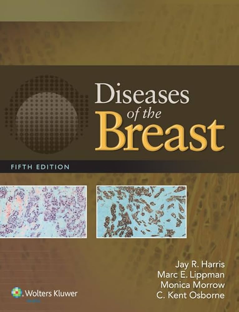 Diseases of the Breast 5e: 9781451186277: Medicine & Health
