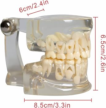 Amazon.co.jp: 歯列模型 子供の乳歯モデル子供の透明歯のモデル 乳歯と