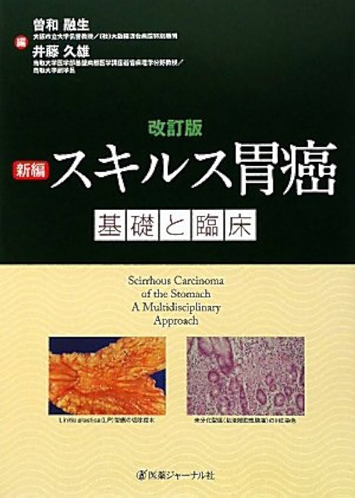 新編スキルス胃癌基礎と臨床 改訂版 | 曽和 融生 |本 | 通販 | Amazon