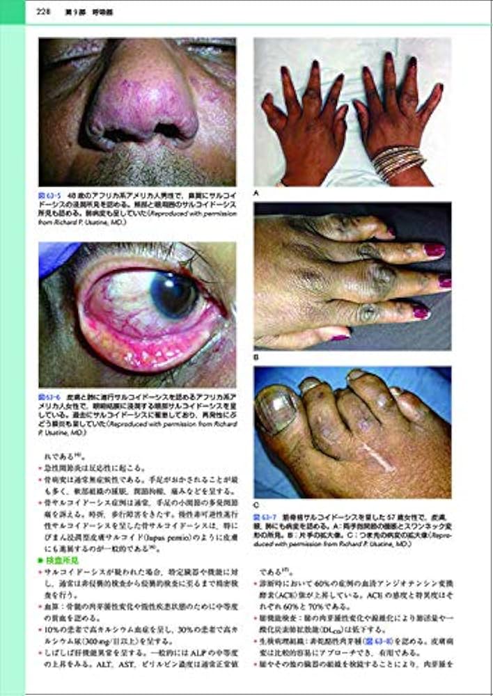 カラー版 国際診療のための内科アトラス大事典 | リチャード・P・ユー