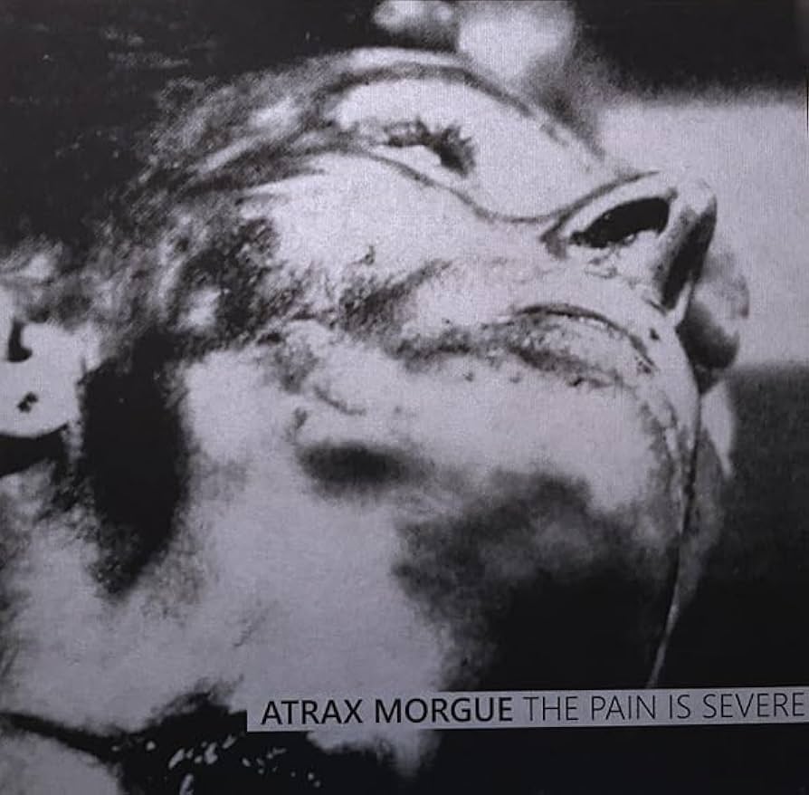 Pain Is Severe : Atrax Morgue: Amazon.es: CD y vinilos}