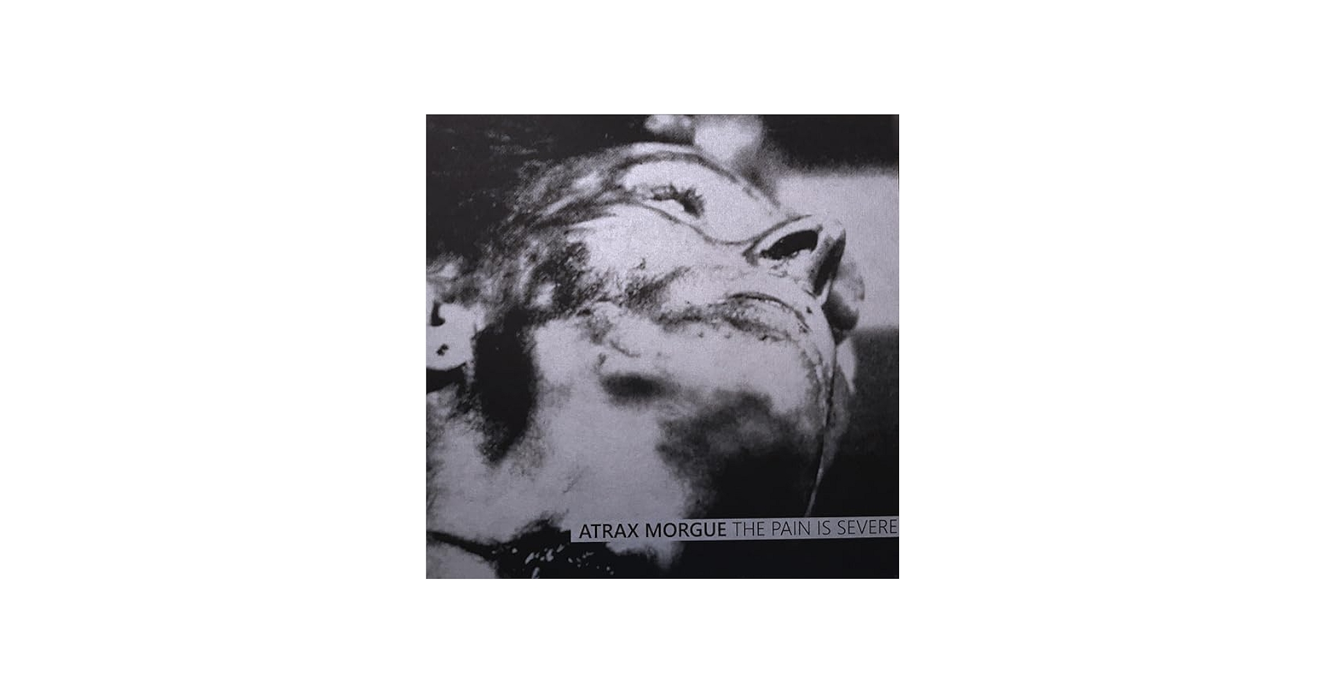 Pain Is Severe : Atrax Morgue: Amazon.es: CD y vinilos}