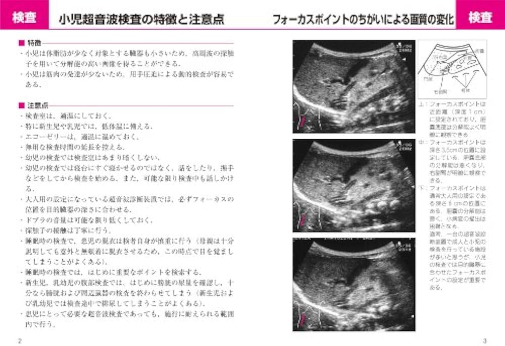 小児アトラス (コンパクト超音波αシリーズ) | 桜井 正児 |本 | 通販