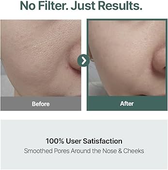 Amazon.com: CELORABY Potension Pore Tightening Boost Serum