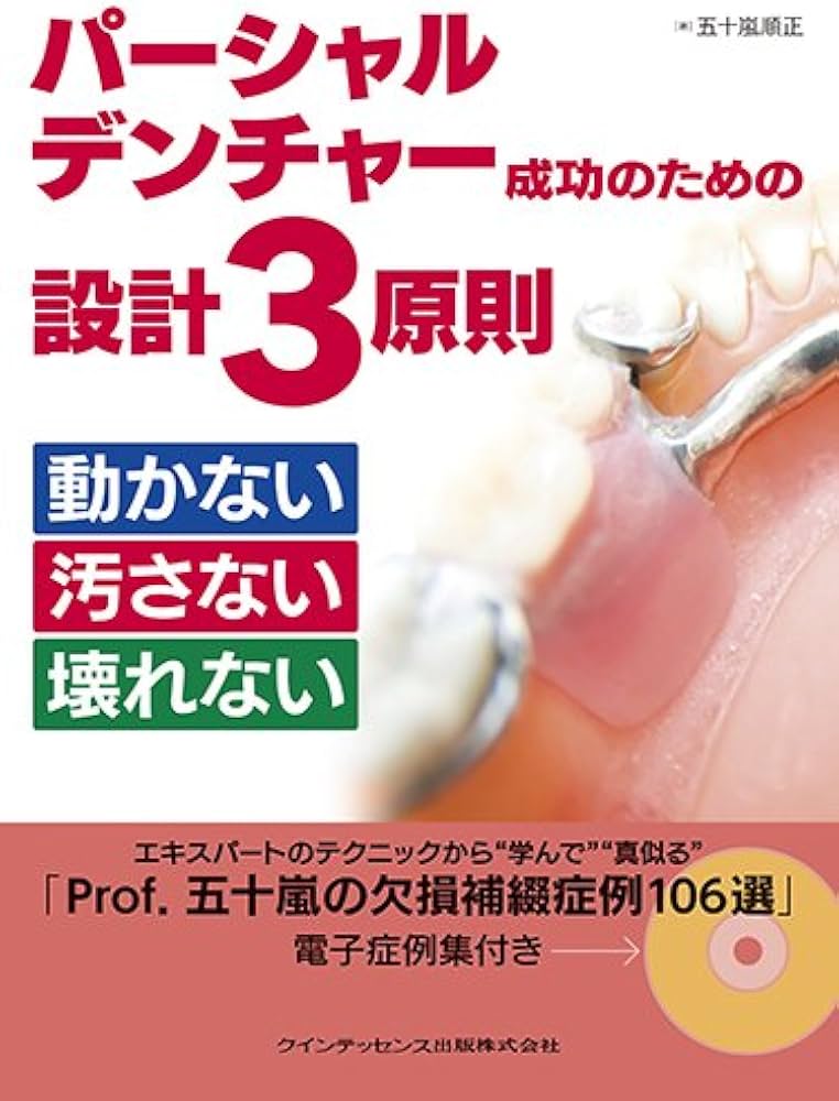 パーシャルデンチャー成功のための設計3原則 動かない 汚さない 壊れ