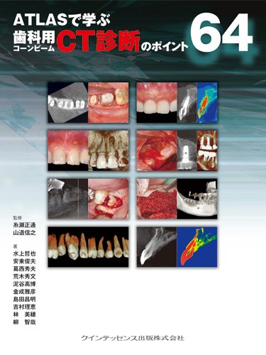 Amazon.co.jp: ATLASで学ぶ 歯科用コーンビームCT診断のポイント64