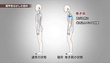 DVD】明日からできる! 福辻式肩甲骨はがし (DVD-Video) | 福辻鋭記 |本