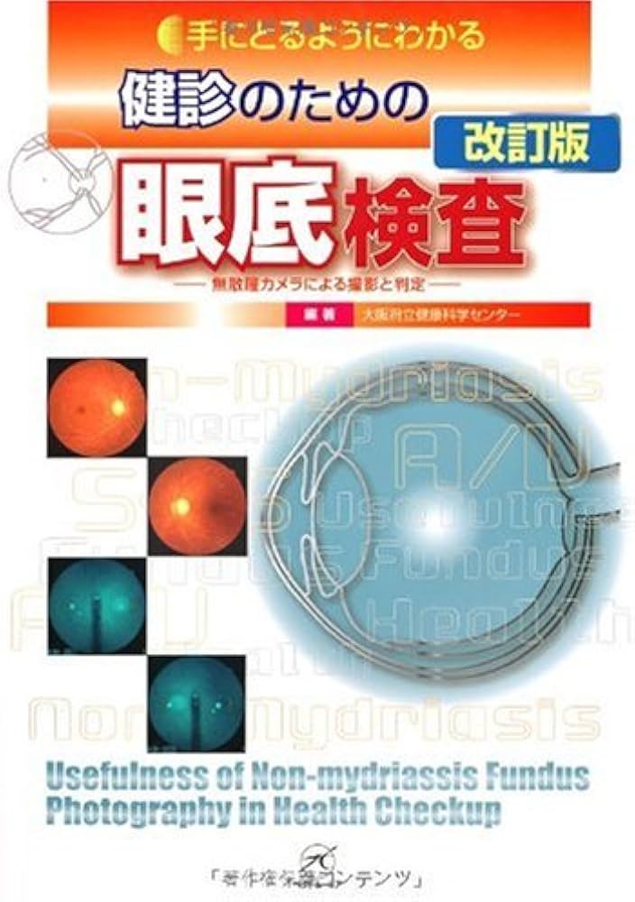 健診のための眼底検査 改訂版〜無散瞳カメラによる撮影と判定〜 (手に