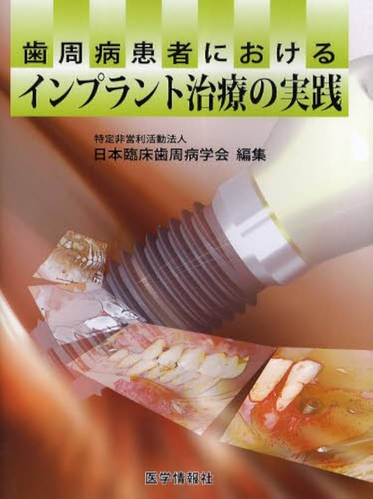 Amazon.co.jp: 歯周病患者におけるインプラント治療の実践 : 日本臨床
