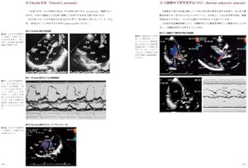 心臓超音波診断アトラス〜成人編〜 改訂版 (Atlas Series超音波編