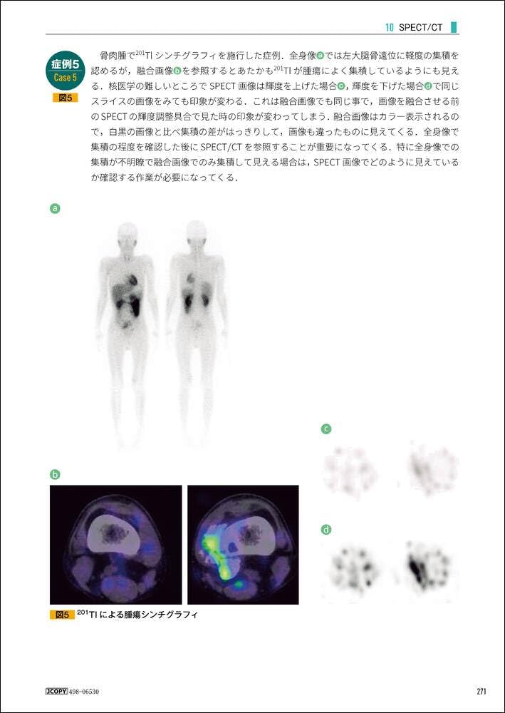 新 核医学テキスト | 絹谷 清剛, 若林 大志 |本 | 通販 | Amazon