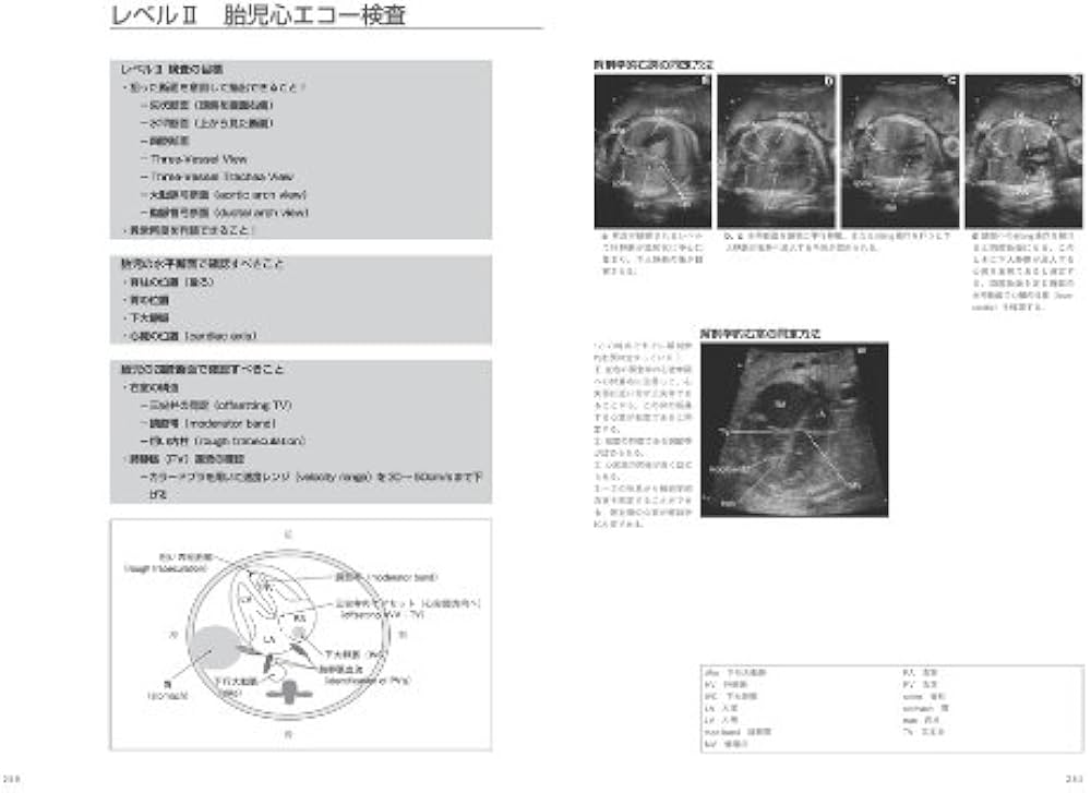 41QoepMYZoL._AC_UF1000,