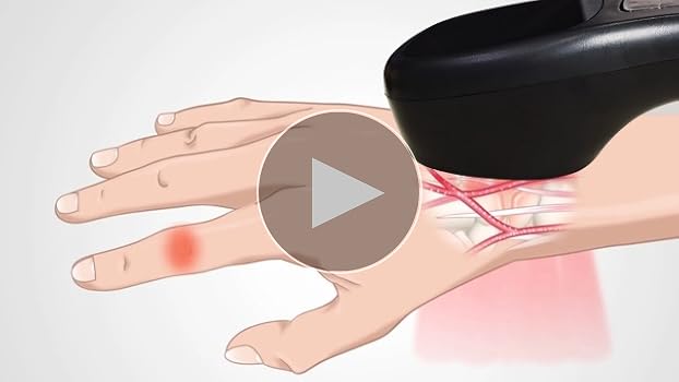 Amazon | スーパーライザー 家庭用 lllt red light 2*808nm 12*650nm