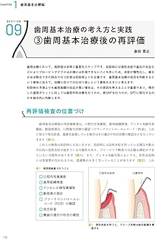 Ishiyaku the BASICS 新ベーシックペリオ: ここからはじめる歯周治療の