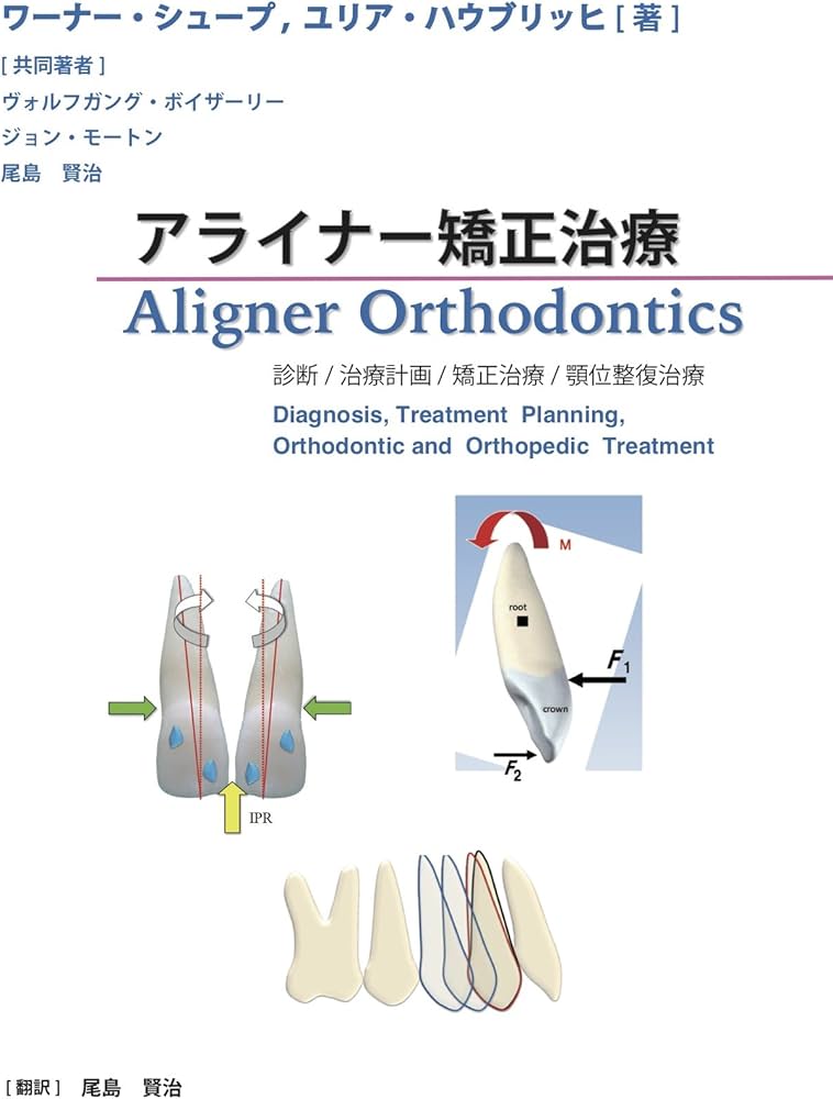Amazon.co.jp: アライナー矯正治療 診断/治療計画/矯正治療/顎位整復