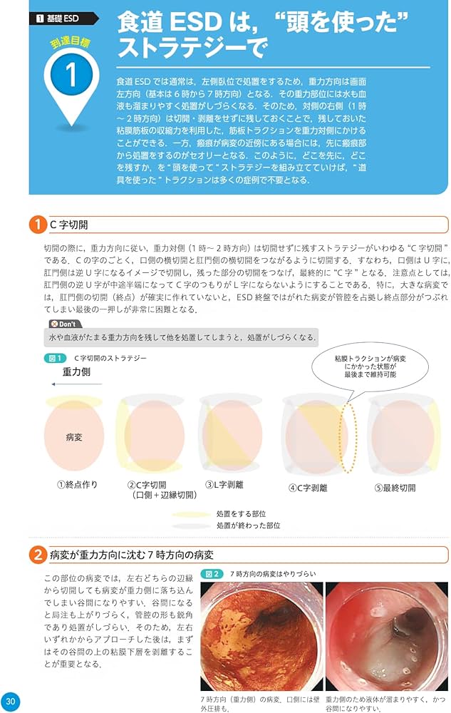 7166LTl4B7L._AC_UF1000,