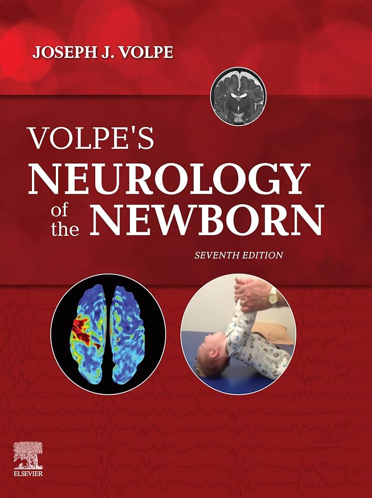 Amazon.com: Volpe's Neurology of the Newborn E-Book eBook : Volpe