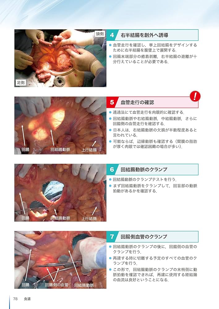 内視鏡外科消化器再建術のすべて | 阿部展次, 上野正紀, 江原一尚