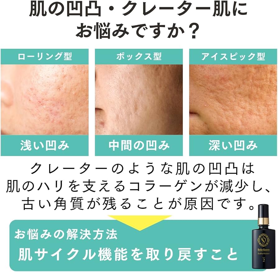 Amazon.co.jp: ドクターRe9 クレーター肌ケア用 ベルクイーンエクソ