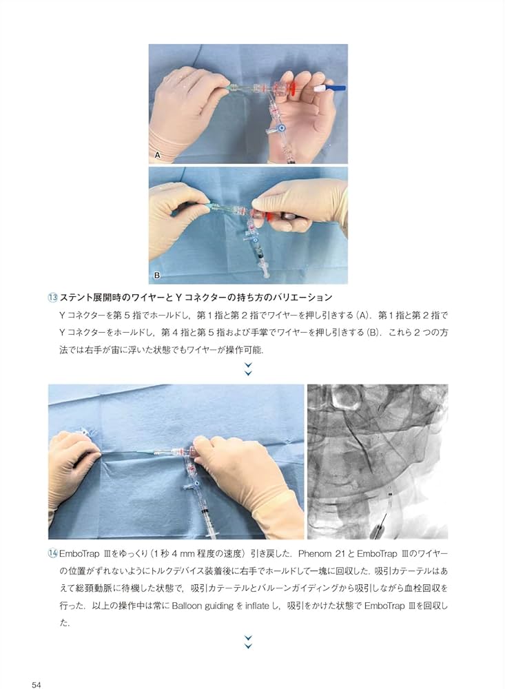脳血管内治療の基本テクニック：コマ送り解説で知識と技術が結びつく