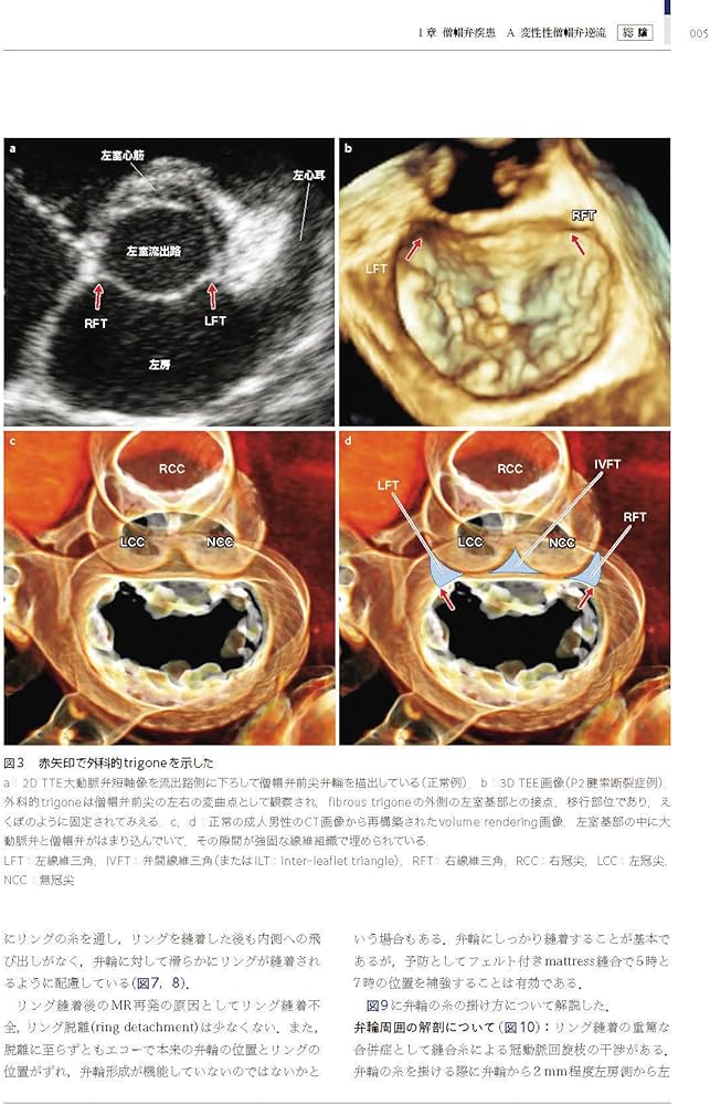 心臓手術ビデオアトラス 手術手技と画像診断［Web動画付］ | 江石清行