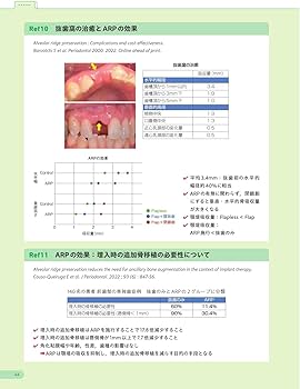 エビデンスに基づいたインプラント治療・骨造成: Early Failure回避の
