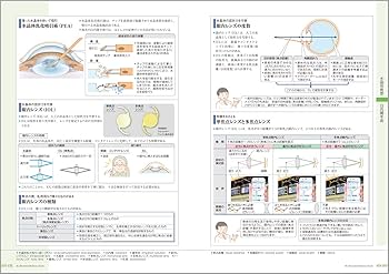 病気がみえる vol.12 眼科 第1版 | 医療情報科学研究所 |本 | 通販