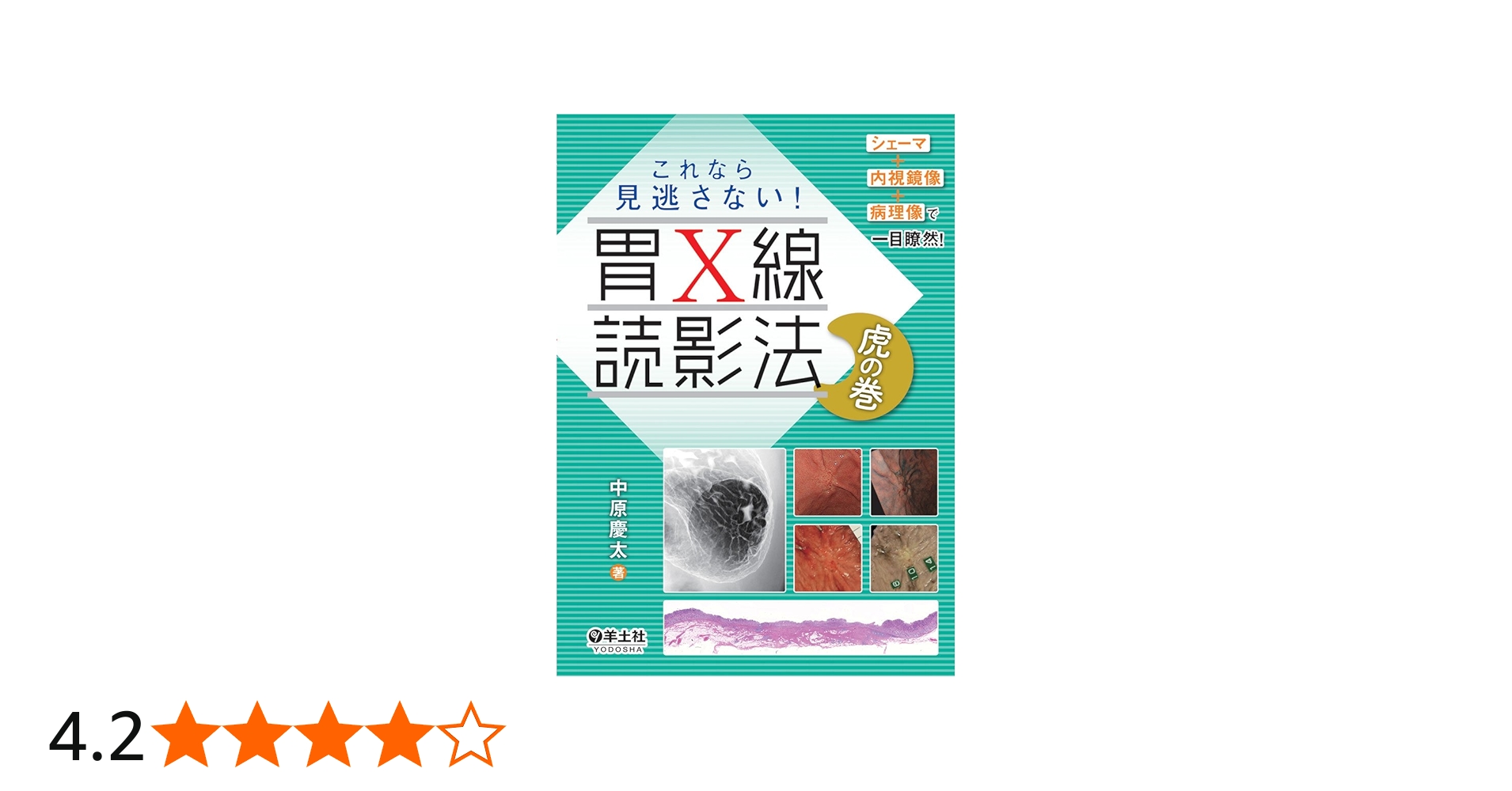 シェーマ＋内視鏡像＋病理像で一目瞭然！ これなら見逃さない！ 胃X線