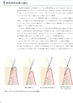 ゼロから見直す歯周外科治療 | 松延 允資 |本 | 通販 | Amazon