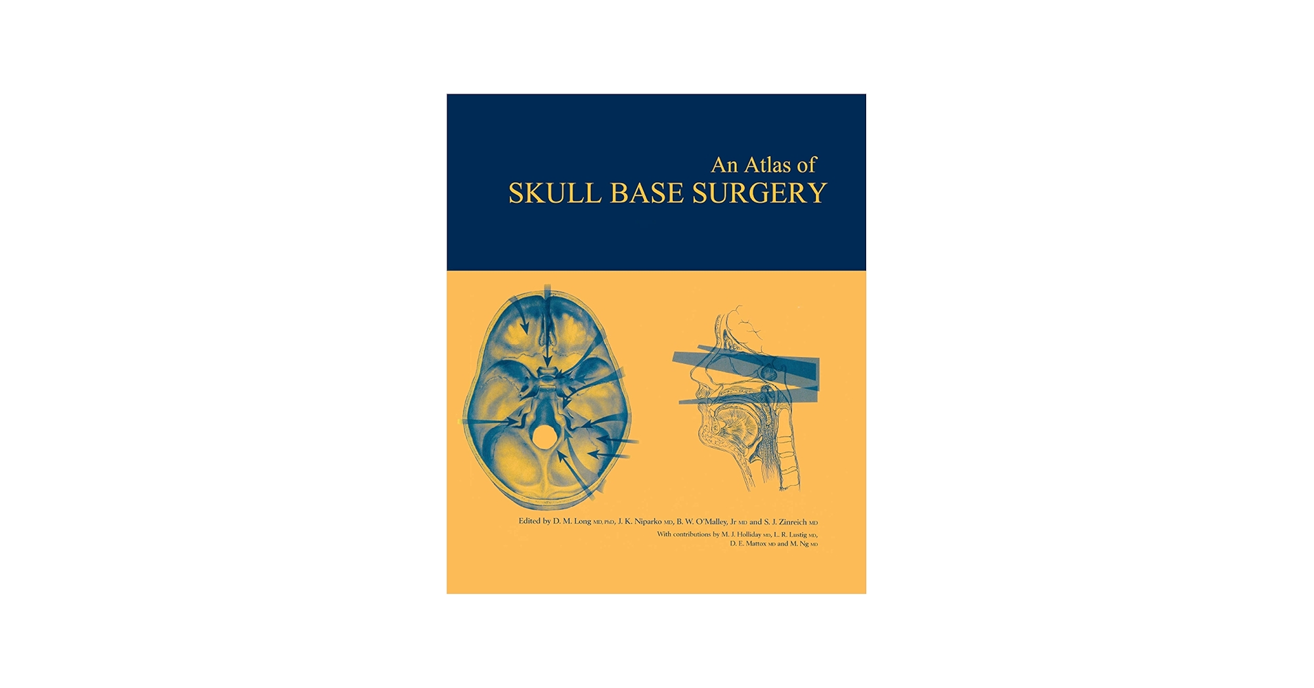 Atlas of Skull Base Surgery (The Encyclopedia of Visual Medicine