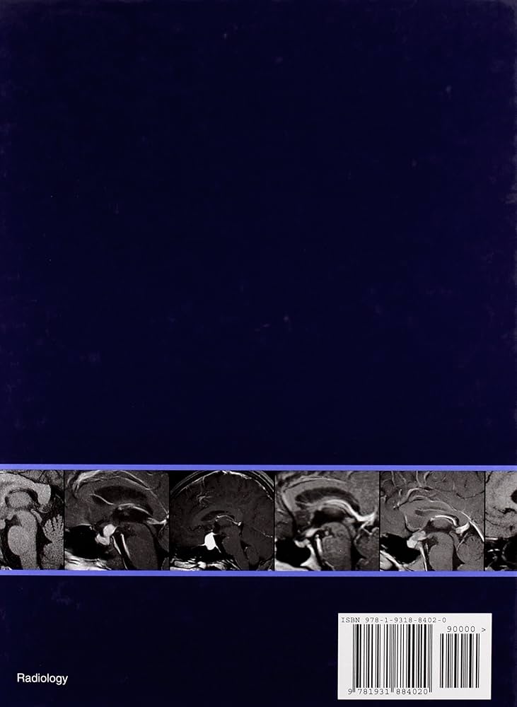 Amazon | EXPERTddx™: Brain and Spine (Expert Differential