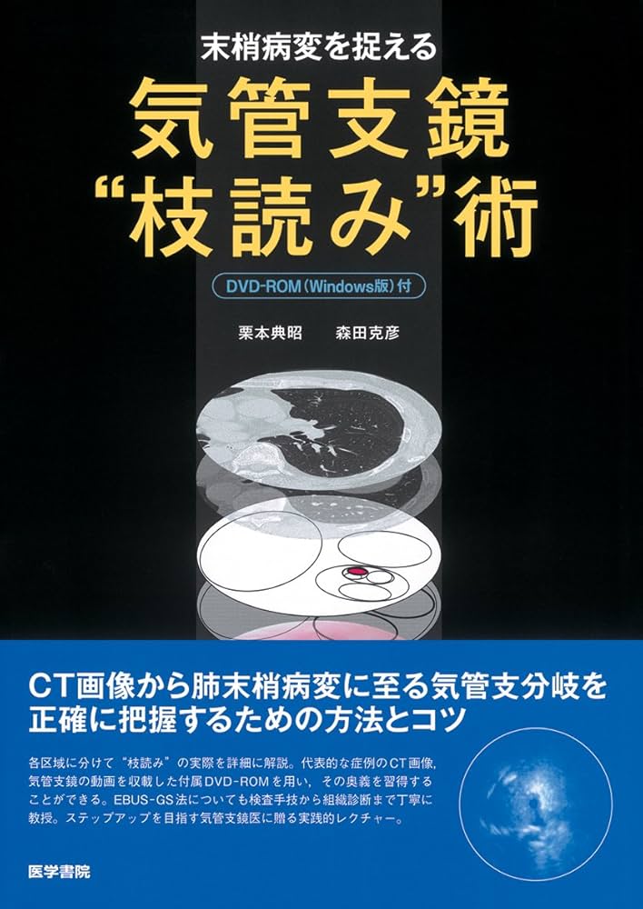 末梢病変を捉える 気管支鏡“枝読み”術 [DVD-ROM(Windows版)付] | 栗本