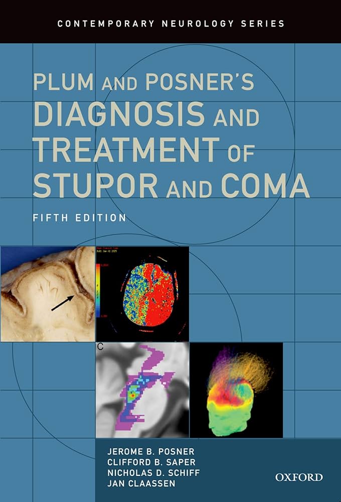 Amazon.co.jp: Plum and Posner's Diagnosis and Treatment of Stupor