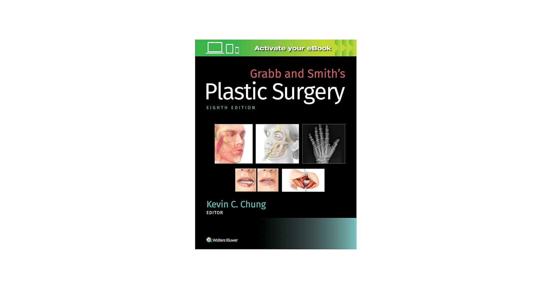 Grabb and Smith's Plastic Surgery: 9781496388247: Medicine