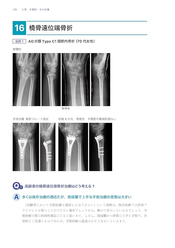 裁断済 「考える」外傷整形外科！ 裁断済み】考える外傷整形外科