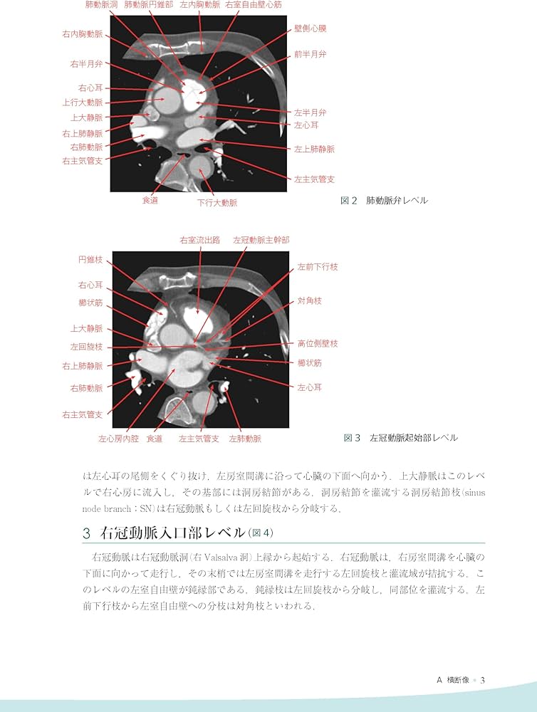 心臓疾患のCTとMRI 第2版 | 佐久間肇, 陣崎雅弘, 北川覚也, 石田正樹