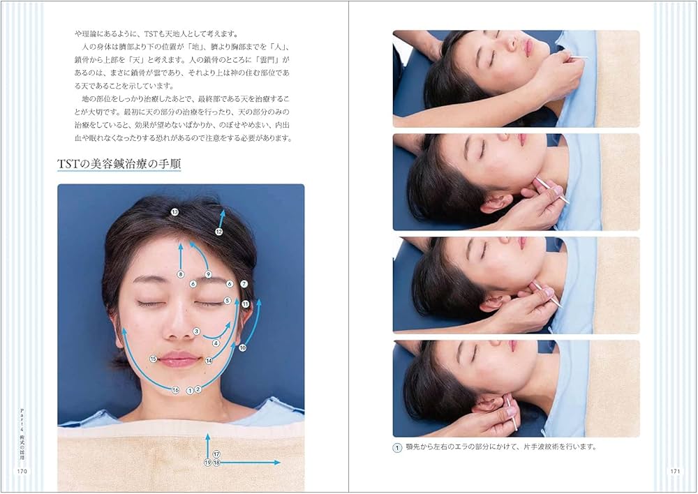 てい鍼テクニックー船水隆広のTST- | 船水隆広 |本 | 通販 | Amazon