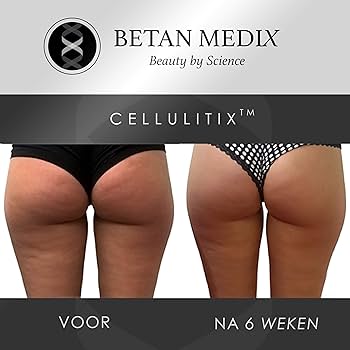 Amazon | セルライト除去クリーム＆マッサージャー：大腿部、臀部用