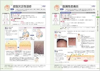 Amazon.co.jp: 病気がみえる vol.14 皮膚科 第1版 : 医療情報科学研究