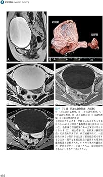 産婦人科の画像診断 第2版 | 田中 優美子 |本 | 通販 | Amazon