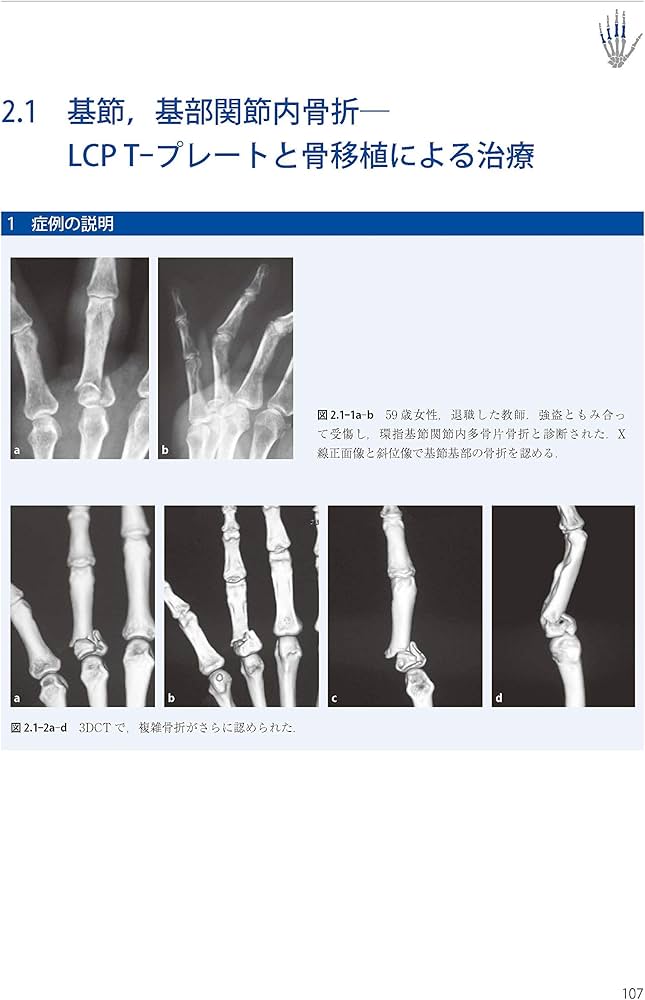 71BxAMYgt9L._AC_UF1000,